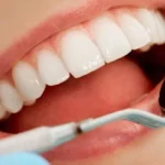 Comprehensive Oral Care in Istanbul