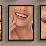 best dentist in Turkey and Istanbul