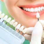 Cosmetic Dentistry in Istanbul: Achieving a Beautiful Smile