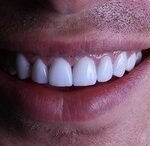 The Perfect Smile: Available Solutions in Istanbul