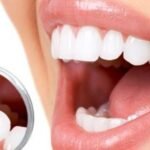 Cosmetic dentistry in Istanbul